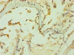 Polyclonal Rabbit anti-Human PPP3CC / CALNA3 Antibody (aa373-512, IHC, WB)