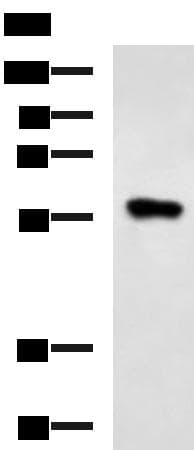 Polyclonal Rabbit anti-Human SQSTM1 Antibody (IHC, WB)