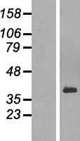 PARD6A / PAR6 Protein (Over-Expression Lysate Myc-DDK (Flag))