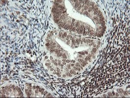 MCTS1 Antibody (aa1-181, clone OTI2F9)