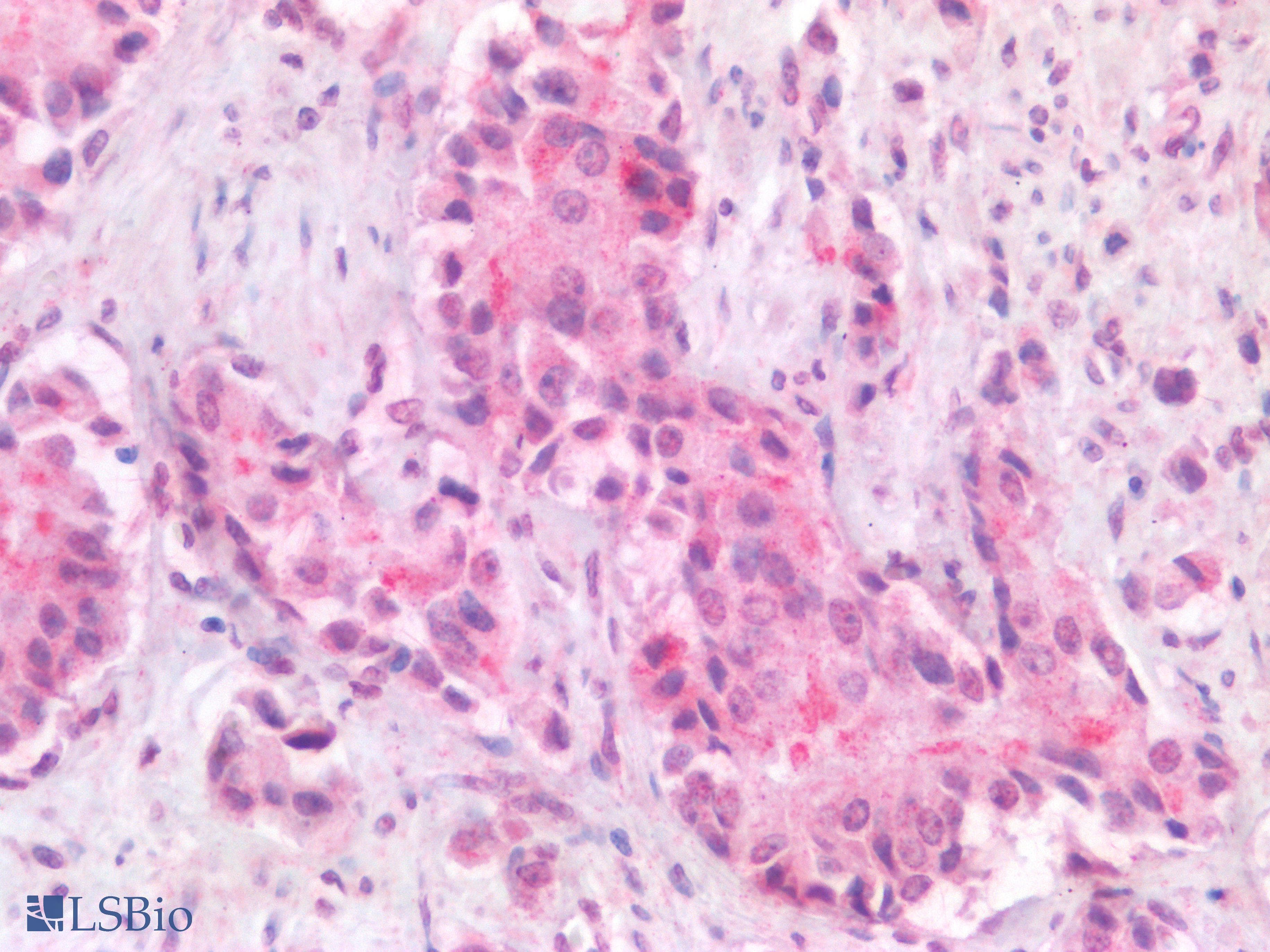PathPlus™ APOBEC3B Antibody
