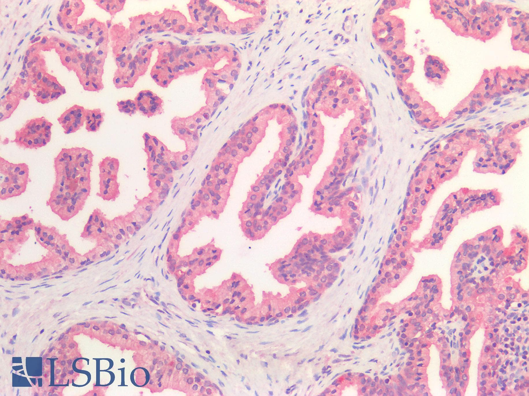 IHC-plus™ HGF / Hepatocyte Growth Factor Antibody
