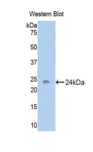 ACVR1B / ALK4 Antibody (aa207-385)