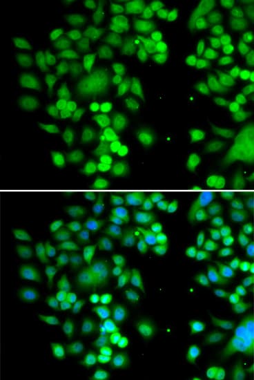 PHYHD1 Antibody