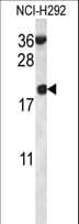 IHC-plus™ RPS12 / Ribosomal Protein S12 Antibody (aa15-44)