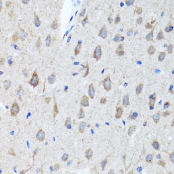 CHAT Antibody