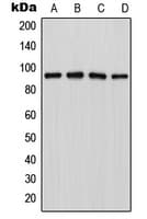 Polyclonal Rabbit anti-Human LZTR1 Antibody (Internal, WB)