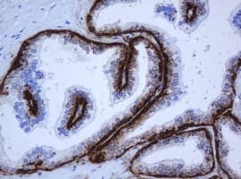 KRT5 / CK5 / Cytokeratin 5 Antibody (Conserved Region, clone OTI1C7, Carrier-free)