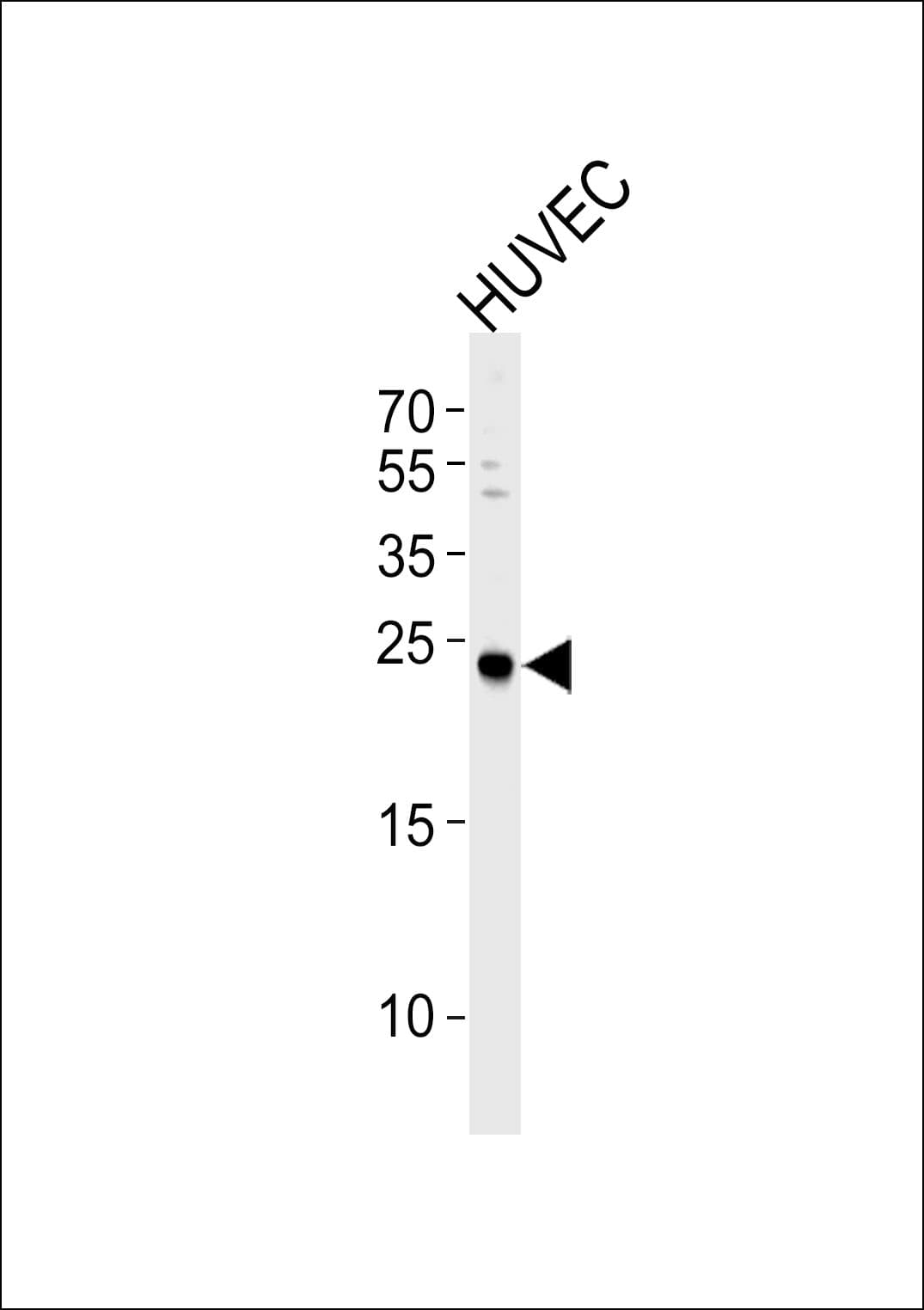 Polyclonal Rabbit anti-Human CSNK2B / Phosvitin Antibody (aa153-184, WB)
