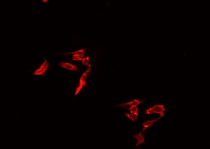 TRIM29 Antibody