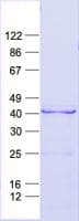 Human HOXB5 Protein (Recombinant His, N-Terminal)