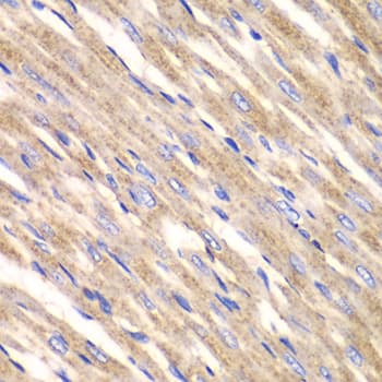Polyclonal Rabbit anti-Human SLC25A4 / ANT Antibody (IHC, WB)