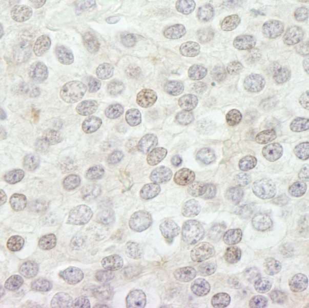 KDM5B / JARID1B Antibody (aa1494-1544)