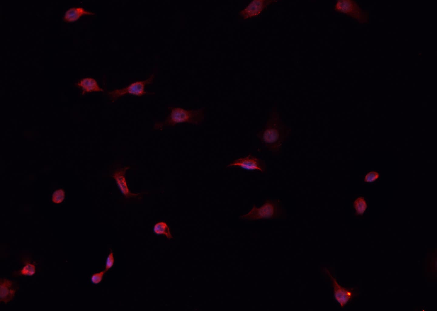 CUL1 / Cullin 1 Antibody