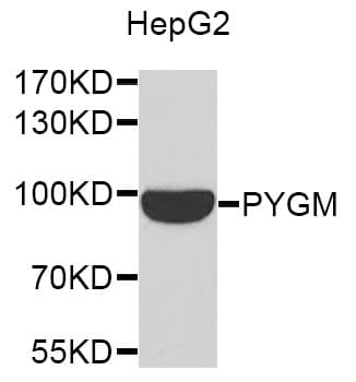 Polyclonal Rabbit anti-Human PYGM Antibody (WB)