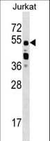 IHC-plus™ CELF2 / CUGBP2 Antibody (aa481-508)