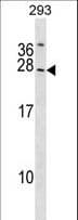 SYNGR2 / Synaptogyrin 2 Antibody (aa28-56)
