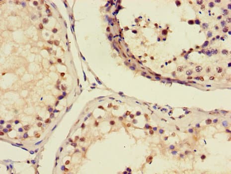 AIM2 Antibody
