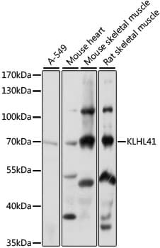 KBTBD10 / Sarcosin Antibody