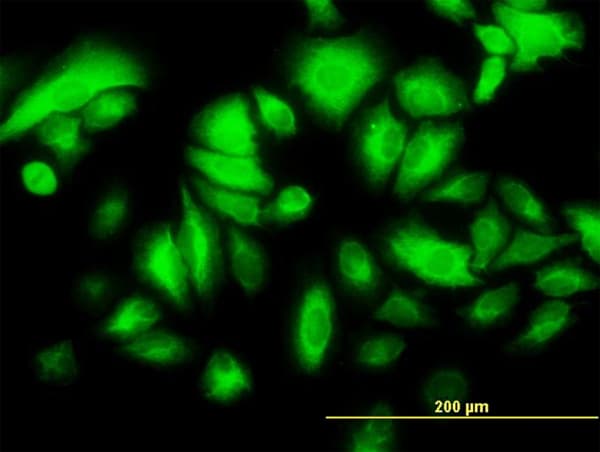 IHC-plus™ KRT17 / CK17 / Cytokeratin 17 Antibody (clone 2D4-1G9)
