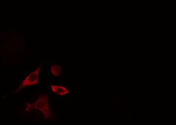 Polyclonal Rabbit anti-Human PLD4 / Phospholipase D4 Antibody (IF, WB)
