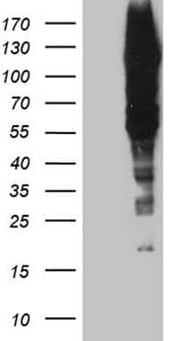 GTF3 / GTF2IRD1 Antibody (aa400-540, clone OTI9A3)