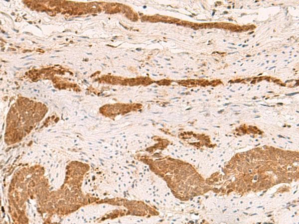 ZFYVE27 / Protrudin Antibody