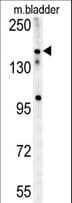 CASZ1 Antibody (aa1574-1601)