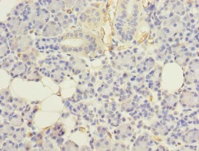 Polyclonal Rabbit anti-Human UBE2G2 Antibody (IHC, WB)