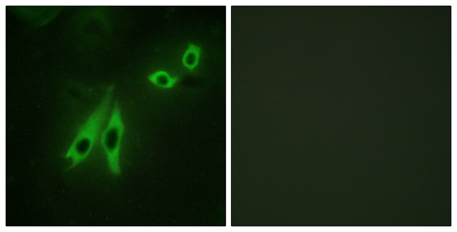 AKAP110 / AKAP3 Antibody (aa191-240)