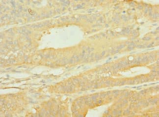 SLC10A2 / ASBT Antibody