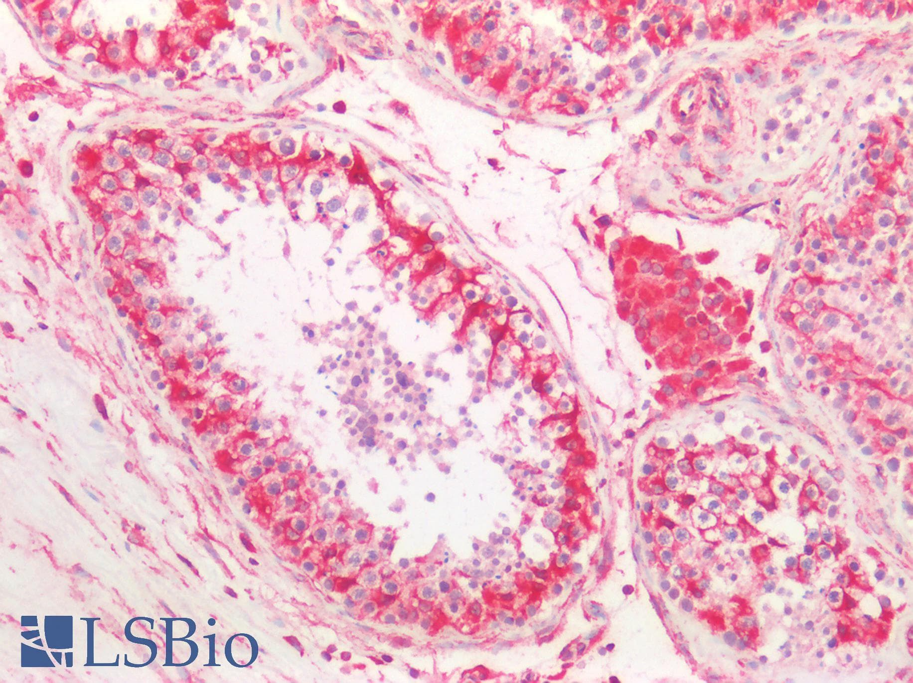IHC-plus™ Vimentin Antibody (aa2-466)