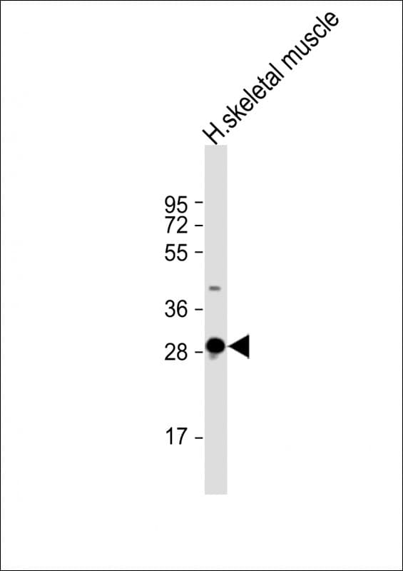 DNASE1L2 Antibody (aa199-229)