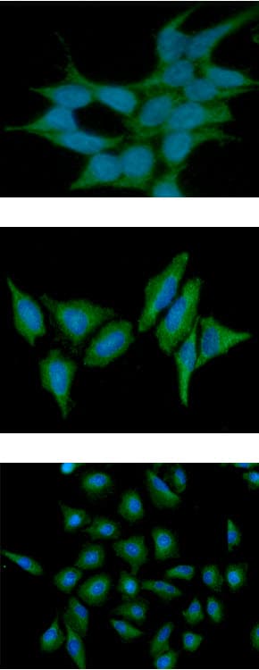ST13 Antibody (clone AT5C6)