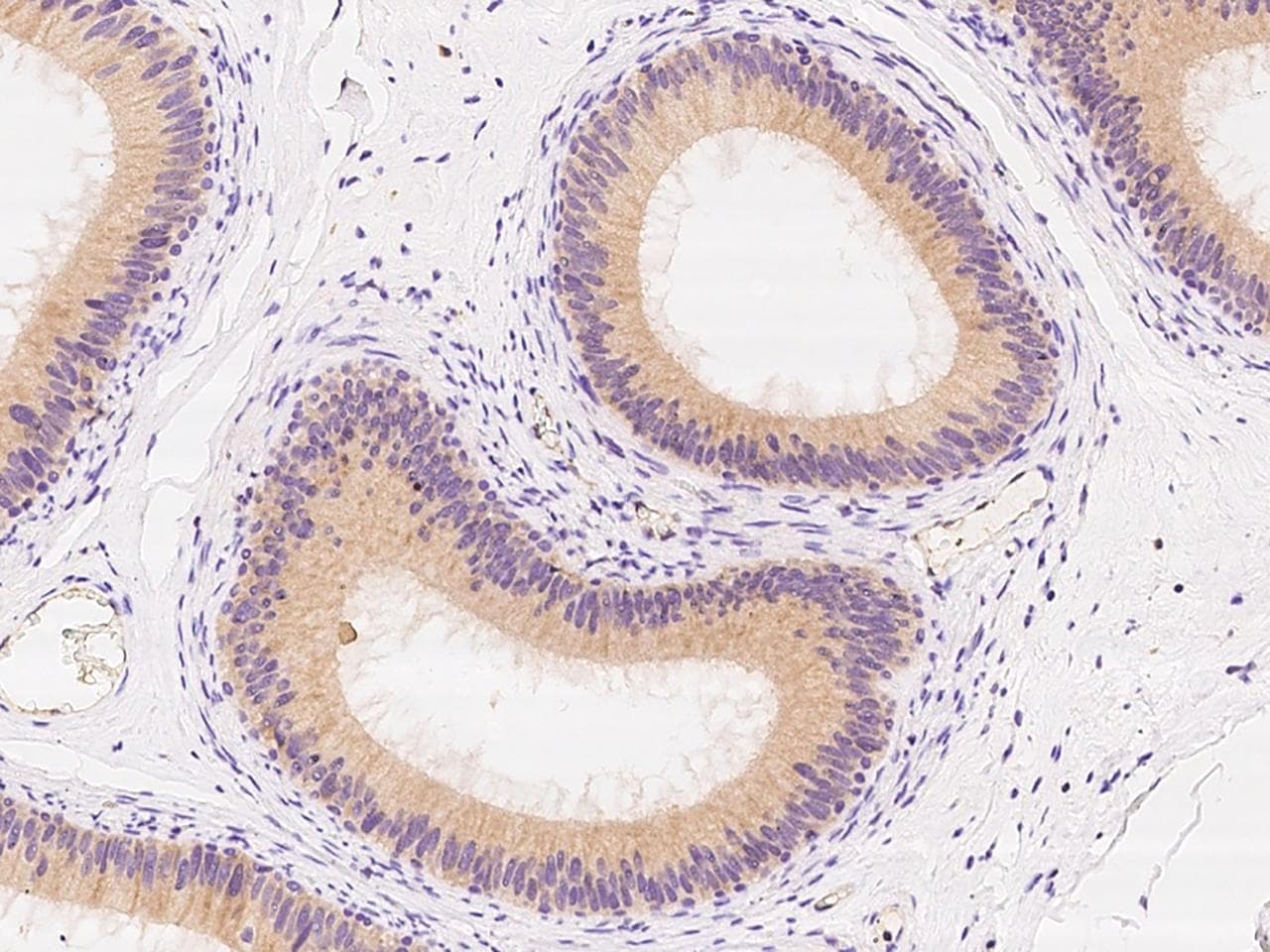 Polyclonal Rabbit anti-Human SCGB2A1 / Mammaglobin B Antibody (IHC)