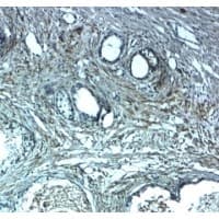 Polyclonal Rabbit anti-Human LRRC26 Antibody (IHC, IF, WB)