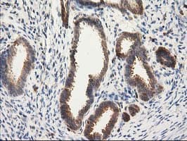 CAT / Catalase Antibody (clone OTI3C3)