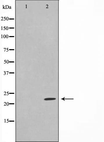 Polyclonal Rabbit anti-Human GBTS1 / DIRAS1 Antibody (IF, WB)