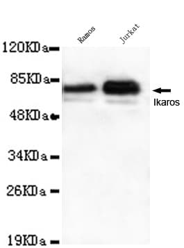 IHC-plus™ Monoclonal Mouse anti-Human IKZF1 / IKAROS Antibody (clone 1A12-F2-D8, IHC, WB)