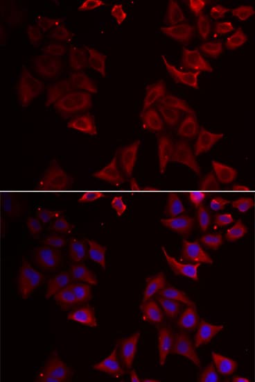 Polyclonal Rabbit anti-Human NCR1 / NKP46 Antibody (IHC, IF, WB)