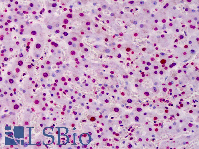 IHC-plus™ Monoclonal Mouse PAR / Poly ADP-Ribose Antibody (clone 10H, IHC, WB)