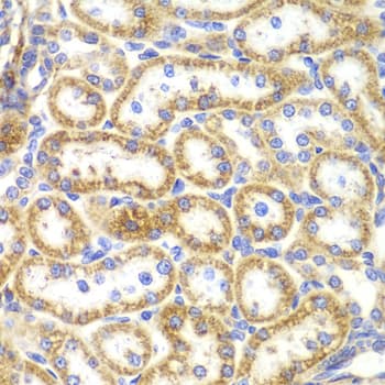 TNFSF11 / RANKL / TRANCE Antibody