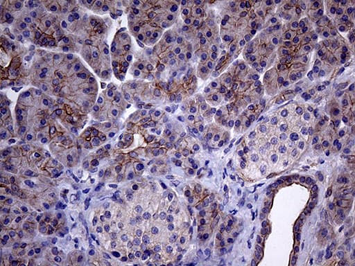 GLS2 / Glutaminase 2 Antibody (clone OTI4C10)