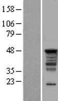 Human PAI-RBP1 / SERBP1 Protein (Over-Expression Lysate Myc-DDK (Flag))
