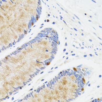 STAT4 Antibody