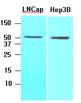 IHC-plus™ ACOT11 / THEA Antibody (aa19-250, clone J4B2)