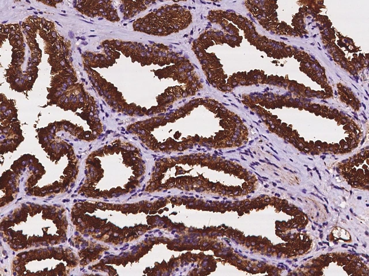 CYB561 Antibody