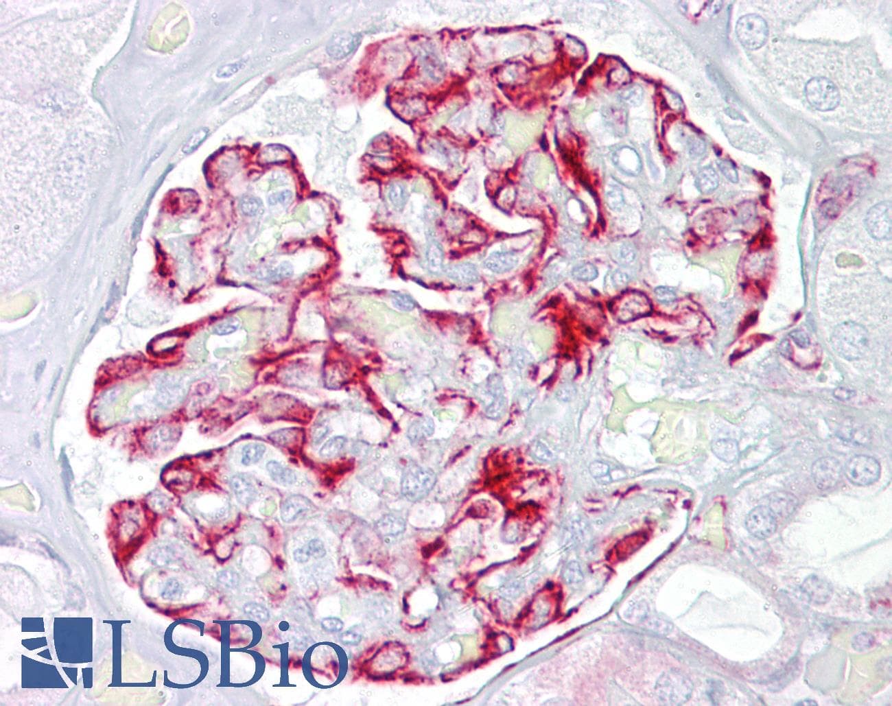 Polyclonal Rabbit anti-Human ALK2 / ACVR1 Antibody (FITC, aa80-129, IHC, WB)