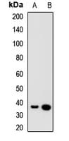Polyclonal Rabbit anti-Human SPY1 / SPDYA Antibody (IF, WB)