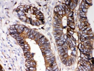 HLA-A Antibody